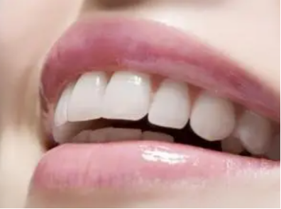 国产种植牙有哪些品牌 国产种植牙品牌排行榜名称