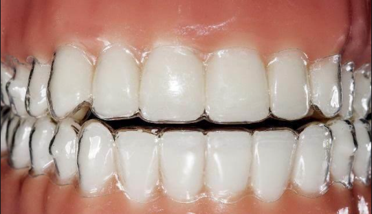 种植牙齿到底痛不痛 是与技术有关吗