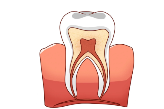 牙贴面对牙齿有伤害吗 牙贴面对牙齿伤害大吗