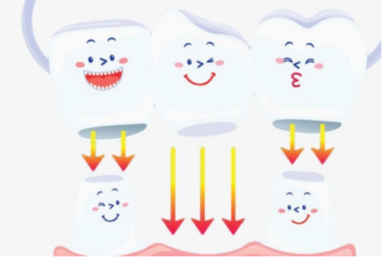 二氧化锆全瓷牙是什么材料
