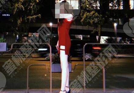 大腿吸脂术后30天