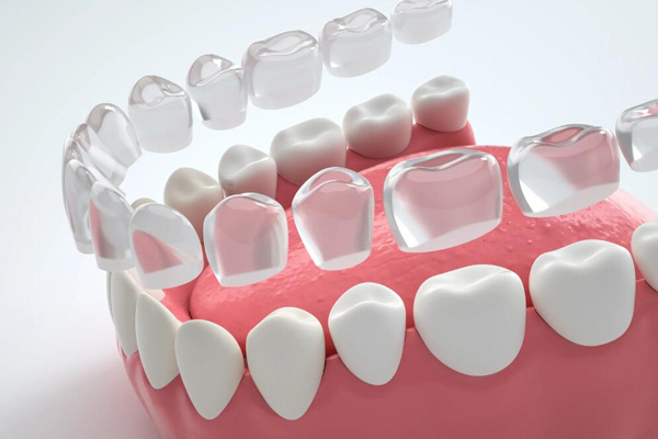 咸阳top10排行种植牙医院公布，优德口腔门诊牙科治疗方面很有实力，榜六牙齿种植方面技术先进！