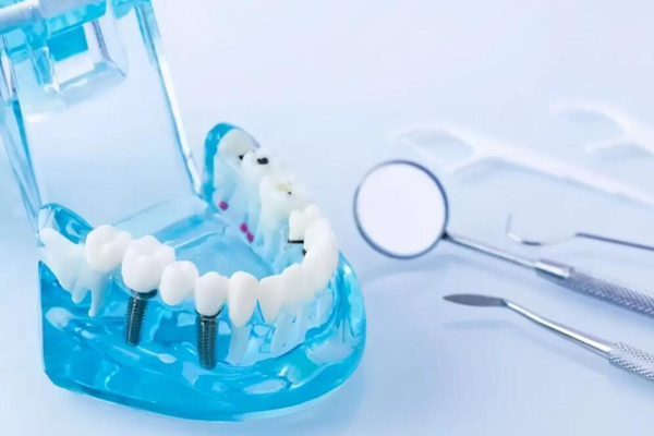 永州靠谱的牙齿种植私立医院排名！牙博士口腔医院有10名以上的医生团队！瑞尔口腔位居第九！