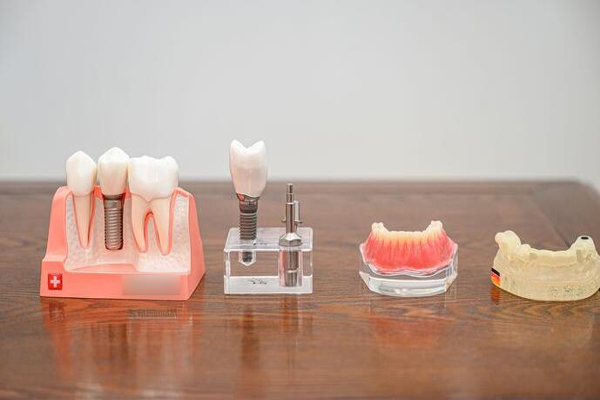 宜宾不错的十家种植牙医院公布，喜牙口腔门诊牙齿种植有技术过硬的医生团队，榜二收费实惠！