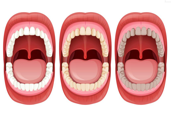 湛江top10种植牙医院排行榜，珠江口腔医院有二级资质齿科设备先进，榜二是家老牌齿科机构！